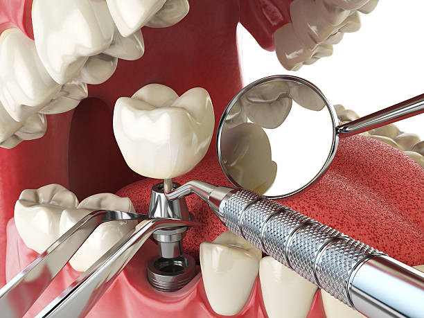 Best Emergency Treatment for Dental Infections or Abscesses in Obion, TN
